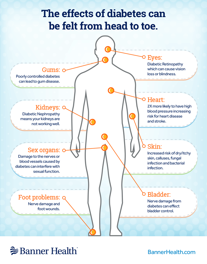 infographic-the-effects-of-diabetes