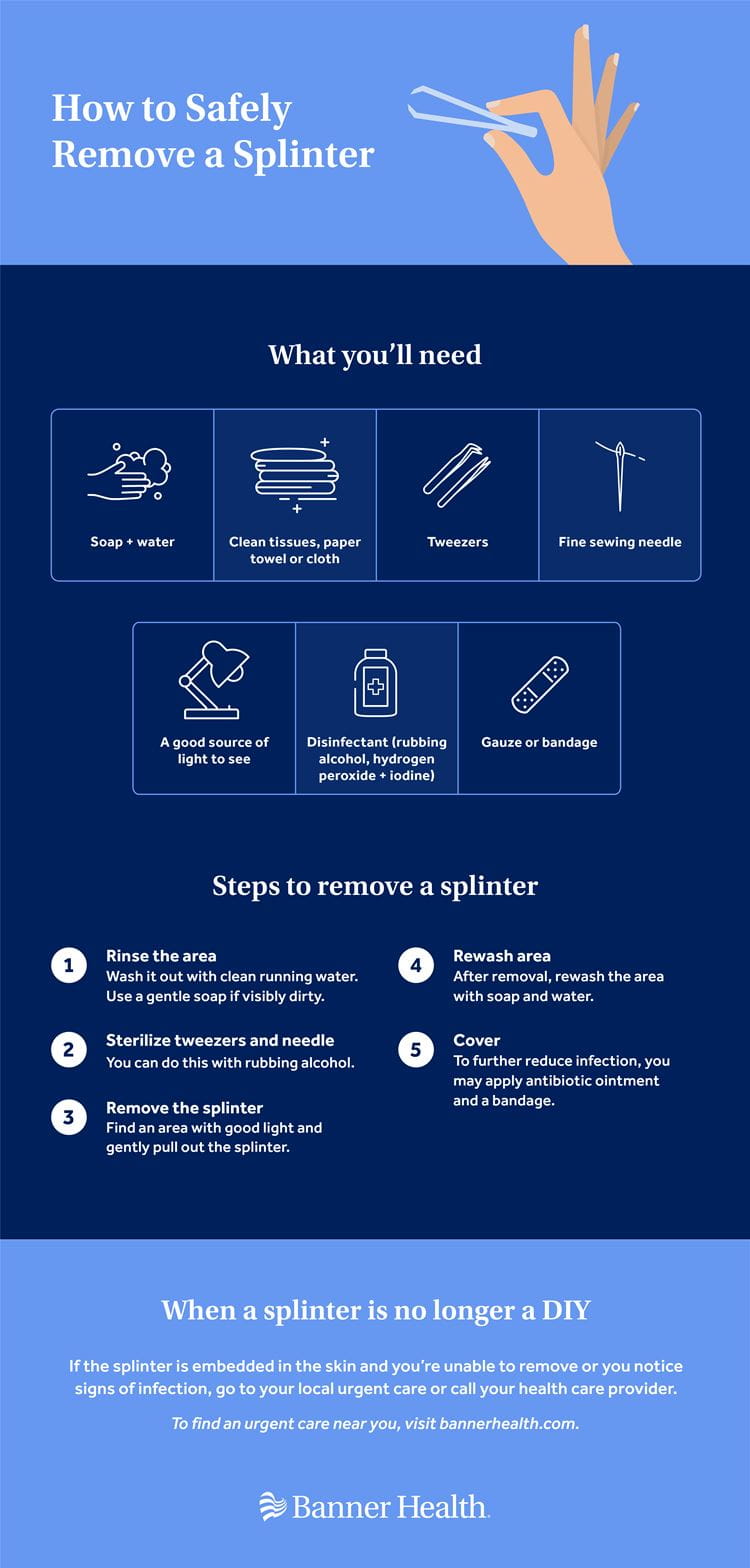 How to Safely Remove a Splinter Infographic