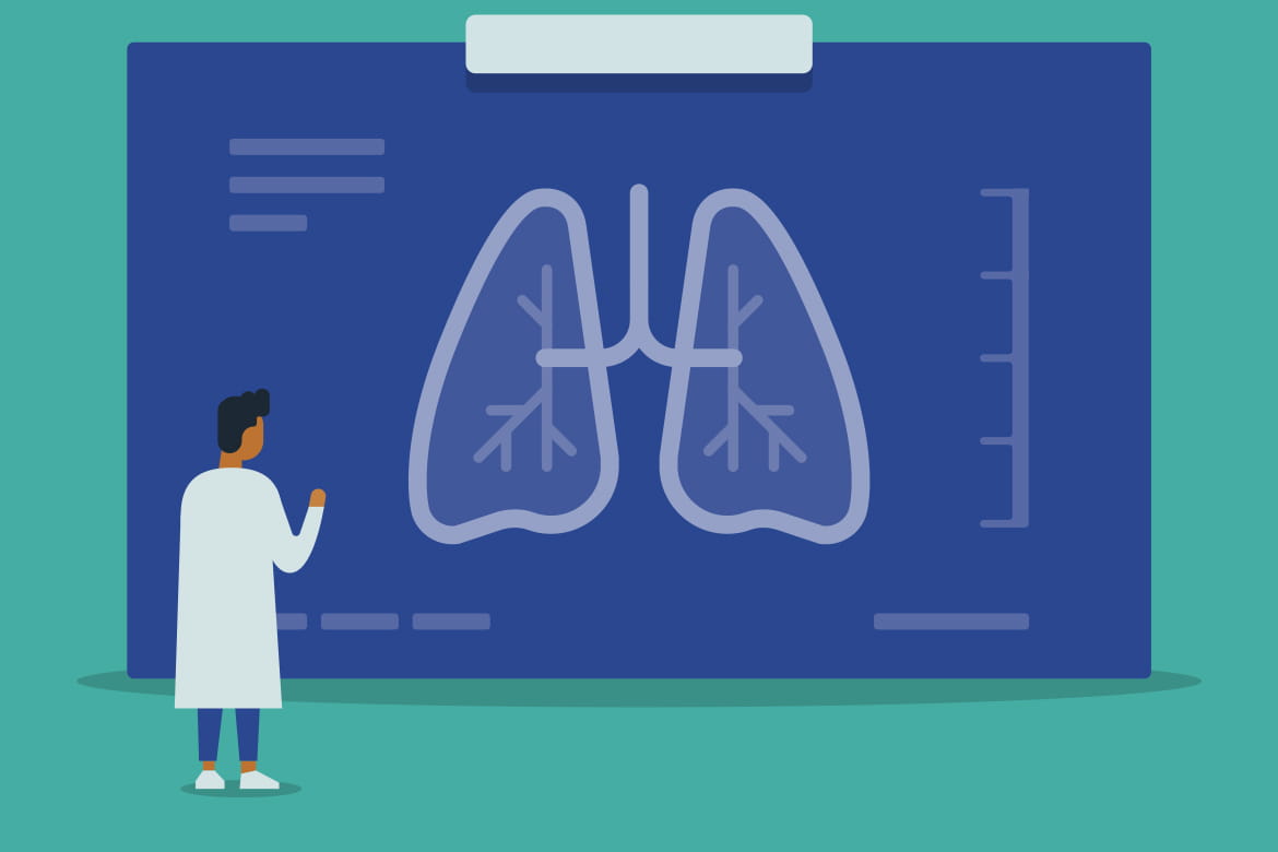 How Quickly Does Aspiration Pneumonia Develop